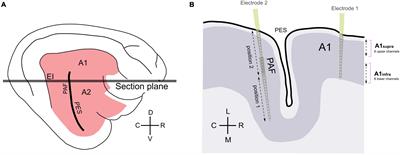 Deficient Recurrent Cortical Processing in Congenital Deafness